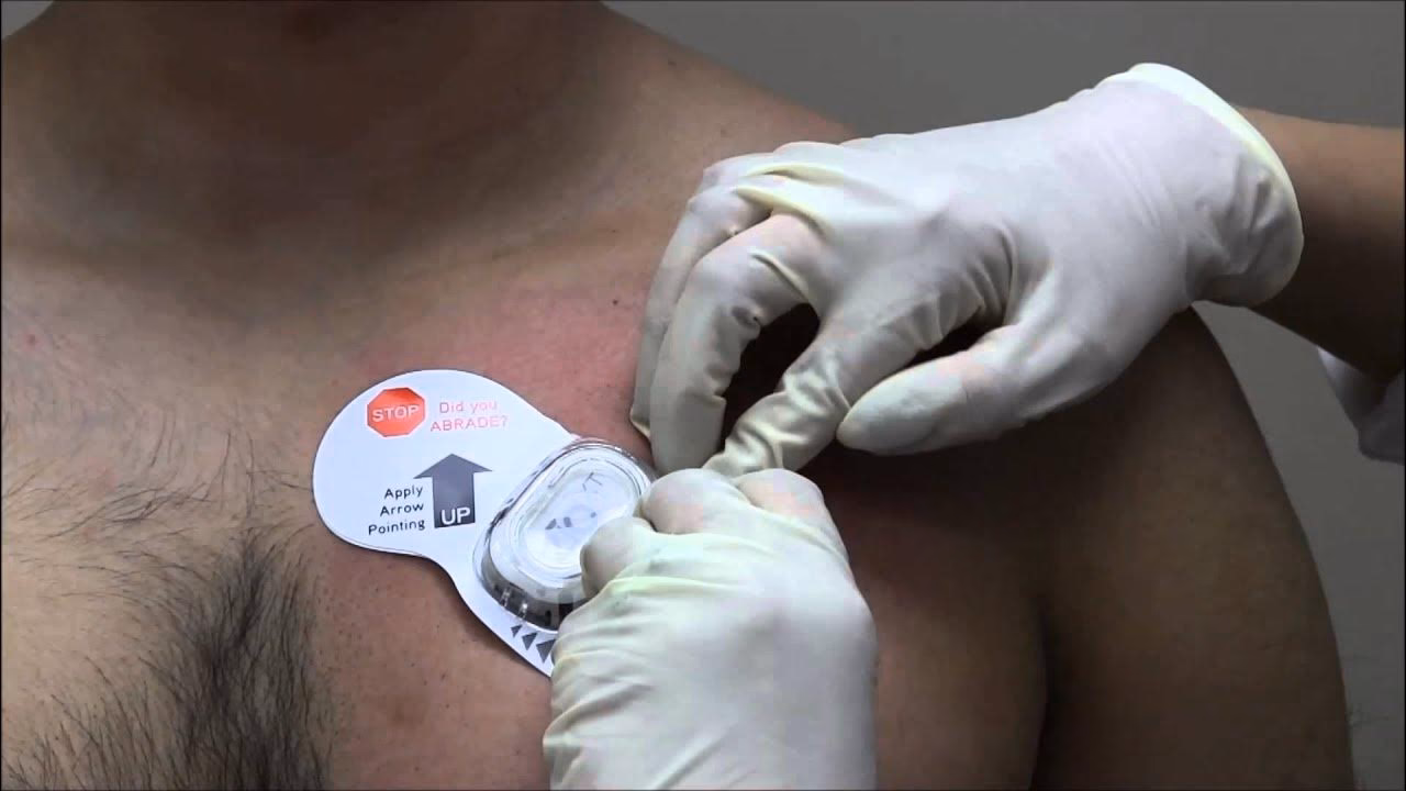 ¿Cómo funciona Zio?